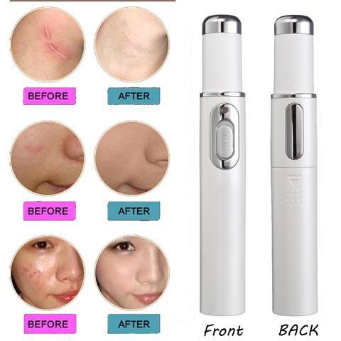 Sleek Therapy Acne Laser Pen Wrinkle Removal